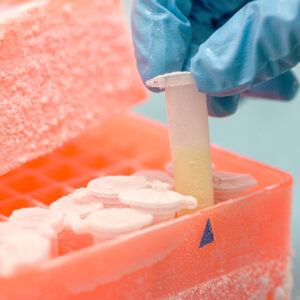 Refrigeration and cryogenization