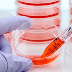Cell culture